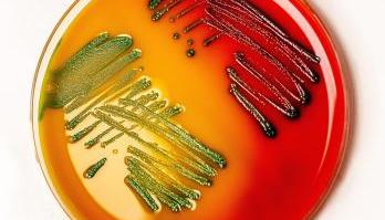 Team Smartfood verwelkomt Analist microbiologie Dieke klein Holkenborg 